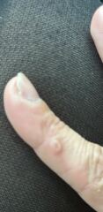 What’s this on my finger?