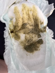 Puramino poo- is this normal?