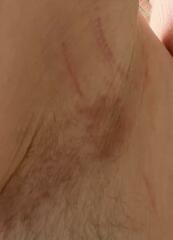 Message from Mitchum regarding skin issues