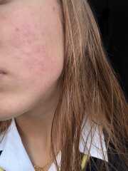 Help Please. Allergic Reaction!