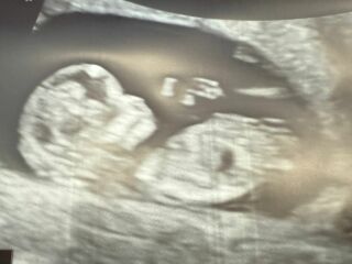 Nub theory guesses on my little baby 🤍
