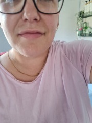 Facial puffiness/swelling  - photos included