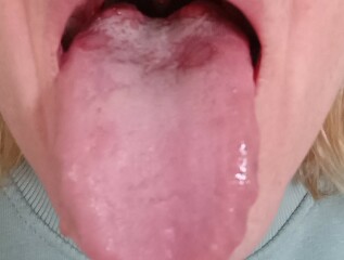 What could be causing my constant raspy throat and soreness?