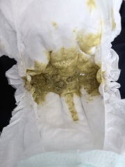 Puramino poo- is this normal?