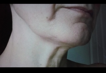 WTF is going on with my face?
