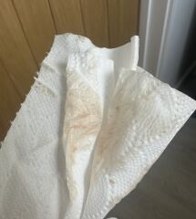 5DPO - what’s going on with my chart