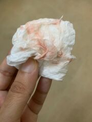 Is this implantation bleeding?