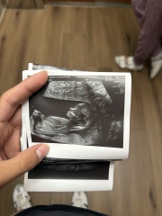Boy or girl? 12 week scan!