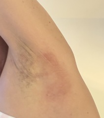 Message from Mitchum regarding skin issues