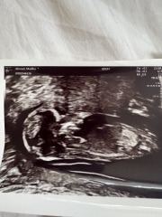 Nub theory guesses on my little baby 🤍