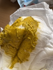 Does this look ‘normal’