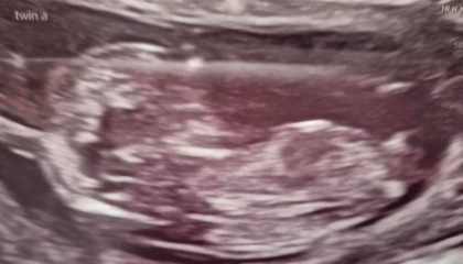 12+4 with twins - nub theory, just for fun!