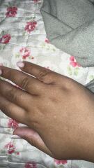 What are these itchy spots?