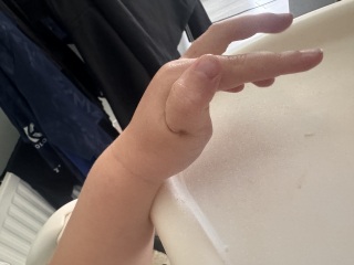 Why does my 2 year old hold his his hands like this?