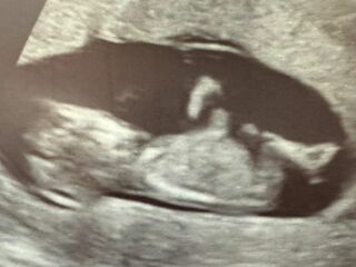 Nub theory guesses on my little baby 🤍