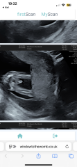 Boy or girl scan?