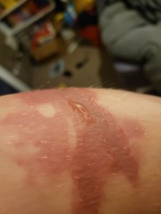 I'll survive without getting this checked out right?