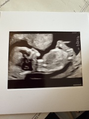 Boy or girl?