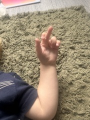 Why does my 2 year old hold his his hands like this?