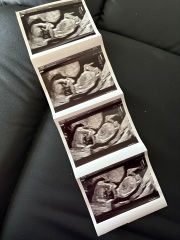 Boy or girl?