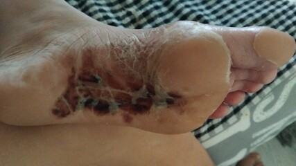 Shamelessly posting for traffic. Medical question and im definitely AIBU for posting disgusting pictures looking for answers