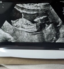 Any gender guesses please!! 🩷💙