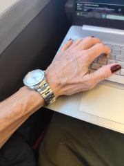 Angelina Jolie, treatment for hand veins?