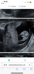Boy or girl scan?