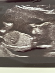 Boy or girl
