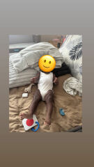 Baby/ 7 month old stiffens legs/arms usually grunts.