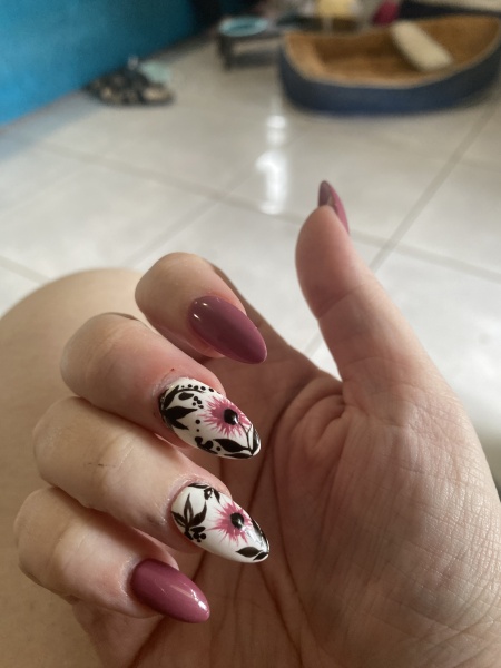 Can I see your nails please?