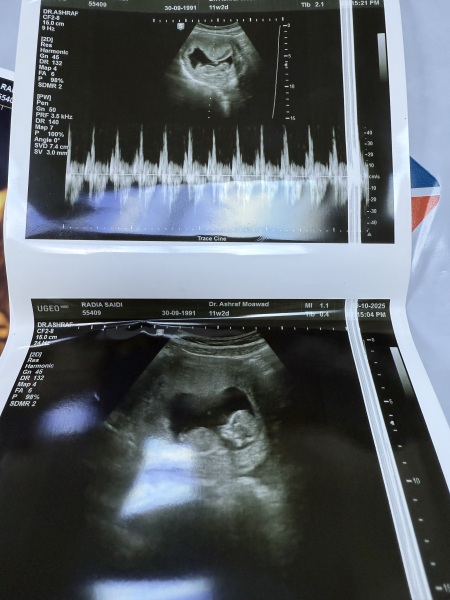 What is the gender of my baby?