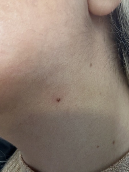 Moles