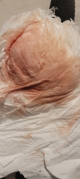 Query about spotting