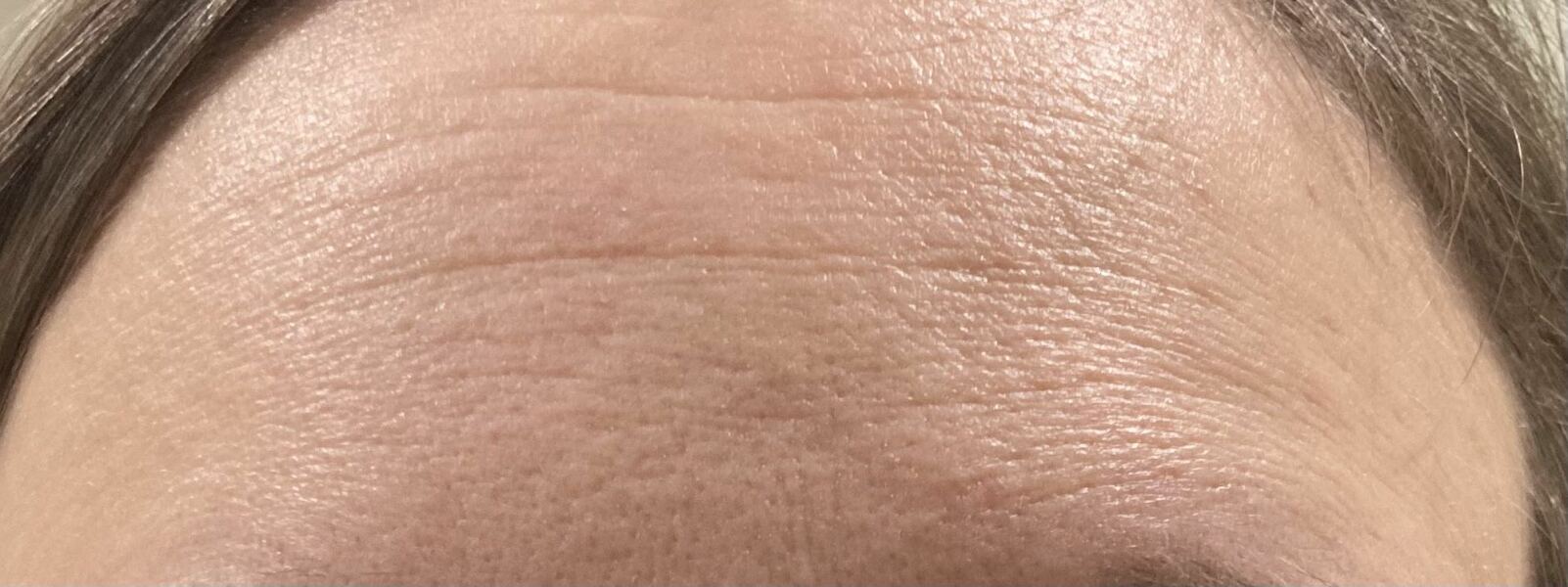 Help me come to terms with my wrinkles