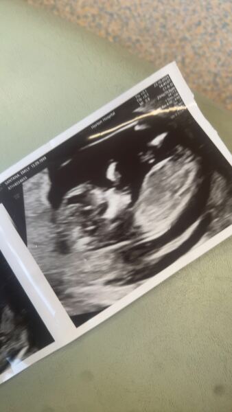 Boy or girl?