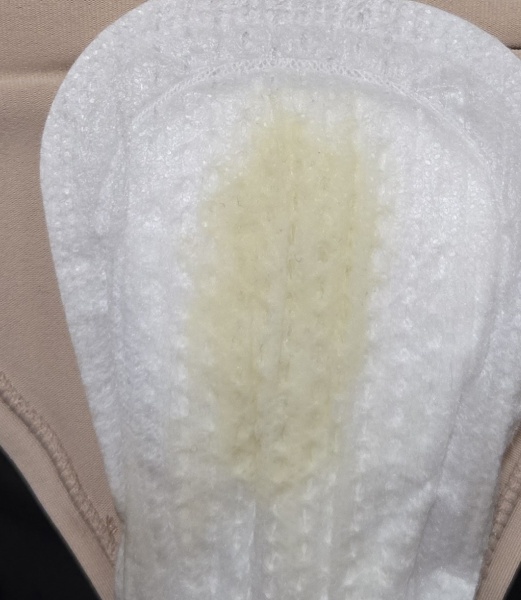 38 weeks - is this yellow discharge or normal