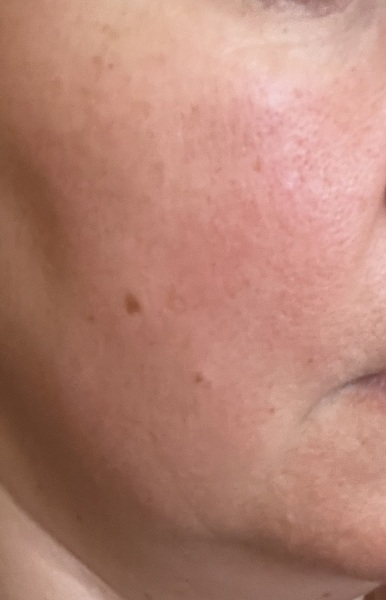 What is going on with my skin?