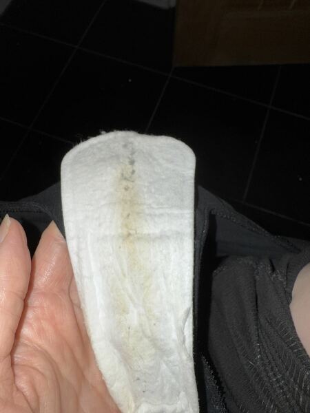 Picture attached (TMI) - is this spotting or normal?