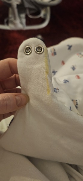 Yellow spit up