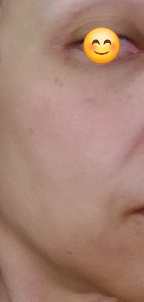 Anyone else stopping due to how aging losing weight is?!