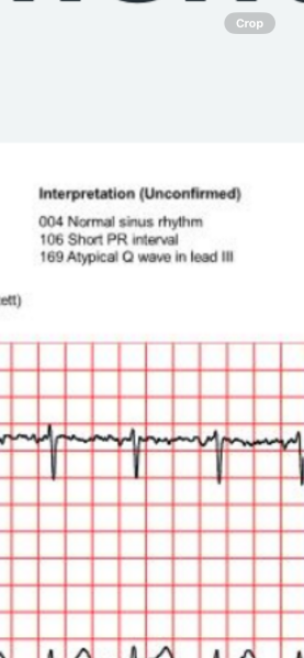 Any cardiologist about please?
