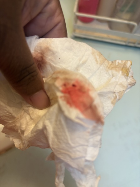 Warning pic attached!! Implantation bleeding?