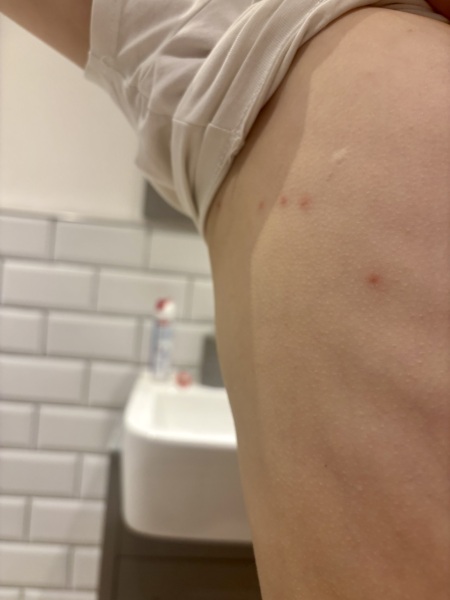 What are these spots on dd8?