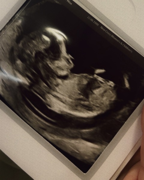 Does this scan look normal?
