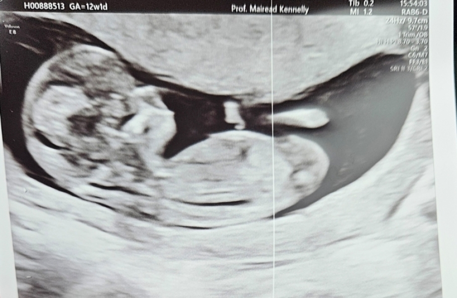 At least we avoided Christmas babies!