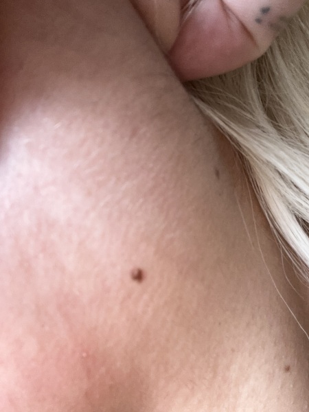 Moles
