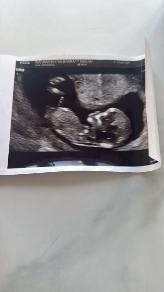 Gender ?