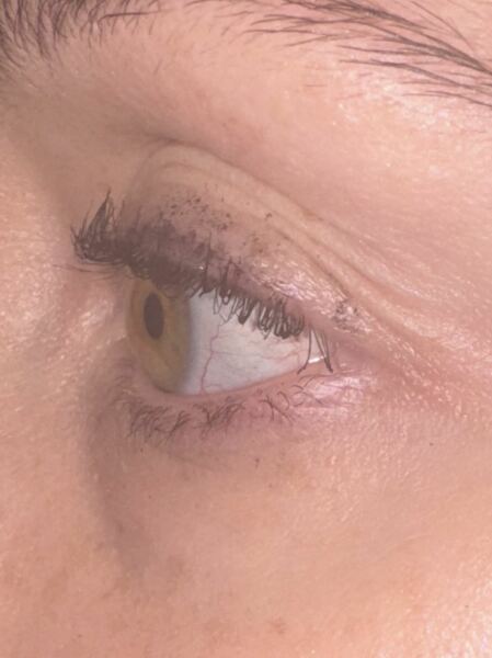 Lash lift gone bad! - Please help