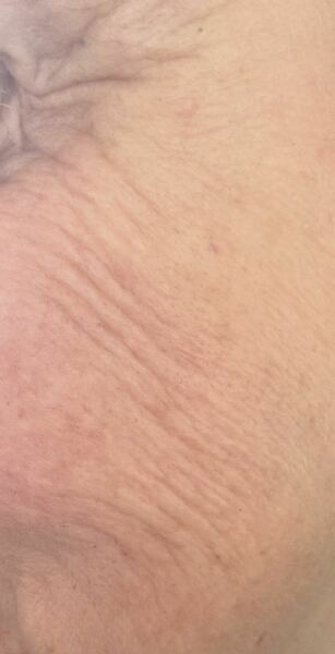 Anyone else stopping due to how aging losing weight is?!